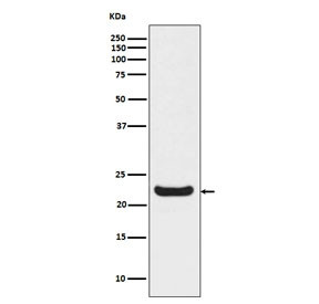 Anti-Retinol Binding Protein 4 / RBP4, clone ACDC-18