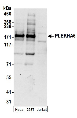 Anti-PLEKHA5