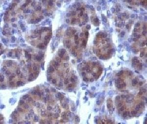 Anti-Golgi Complex (GLG1), clone GLG1/970