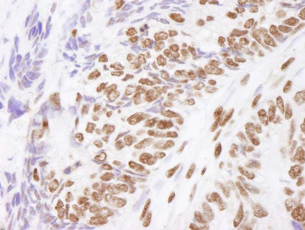 Anti-Matrin 3 (IHC)
