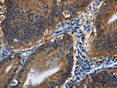Anti-CD46