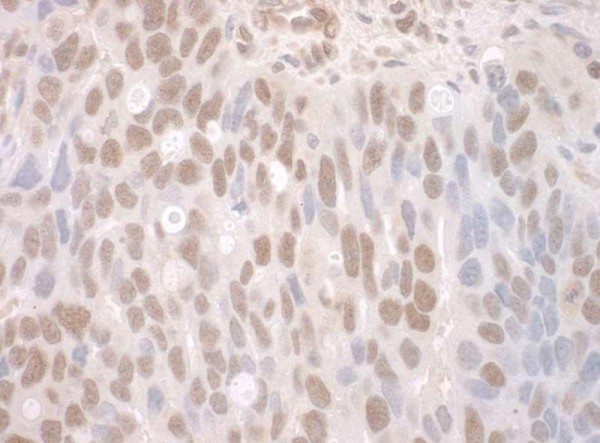Anti-CTNNBL1 (IHC)