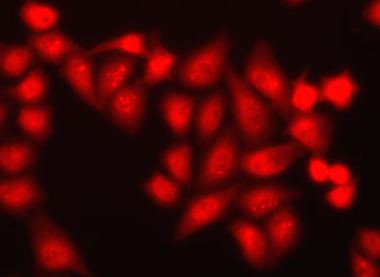 Anti-CHD2