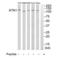 Anti-ATN1