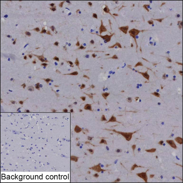 Anti-CELF4