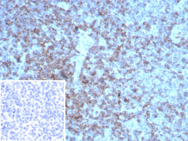 Anti-CD2 / Lymphocyte Function Antigen 2 (LFA-2), recombinant antibody, clone rLFA2/8516