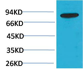 Anti-PI3 Kinase P85beta
