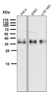Anti-GGH / Gamma glutamyl hydrolase, clone 31G17
