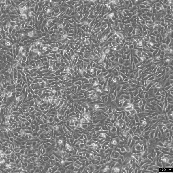 KHM-5M Cells