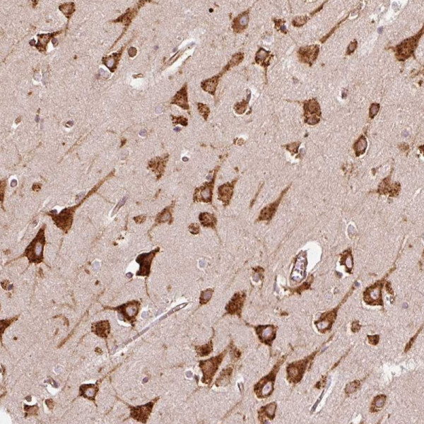Anti-KLC1