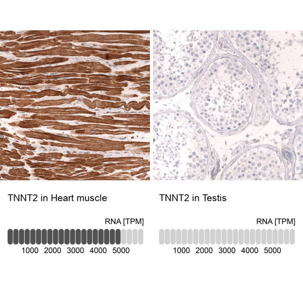 Anti-TNNT2, clone CL13382