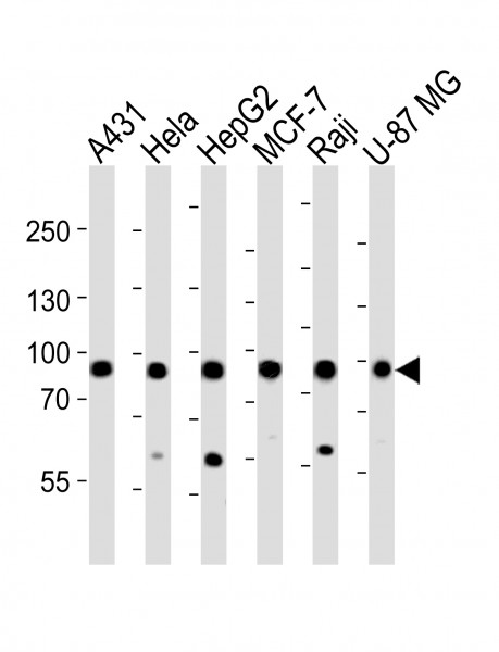 Anti-Mitofilin