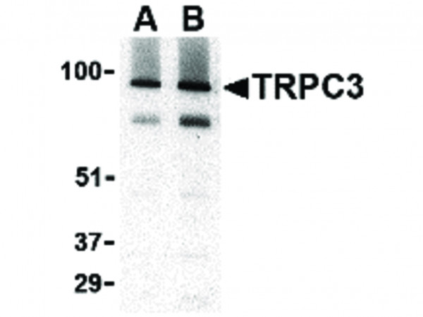 Anti-TRPC3
