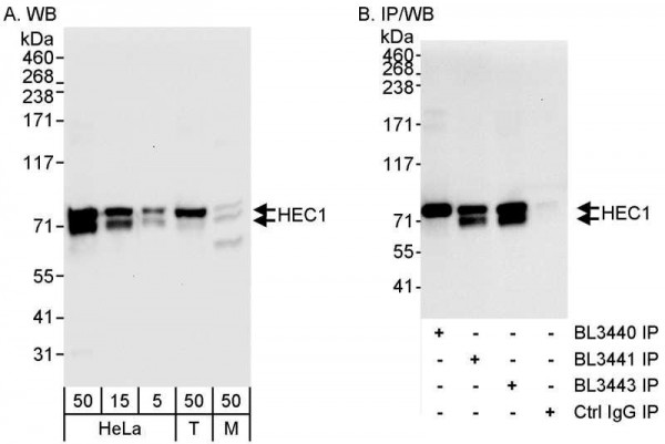 Anti-HEC1