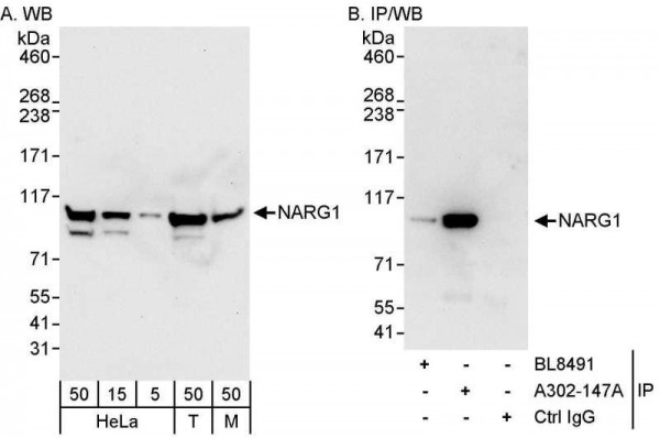 Anti-NARG1