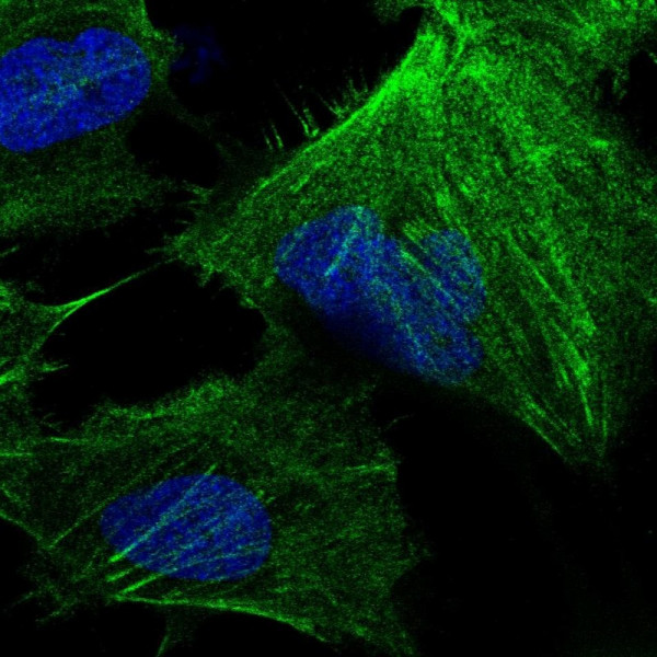 Anti-CTPS1