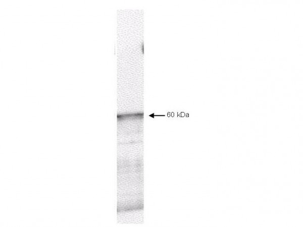 Anti-PDK1 (3-Phosphoinositide-Dependant Protein Kinase-1)