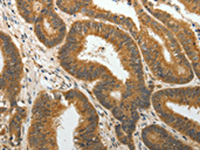 Anti-PTP4A2