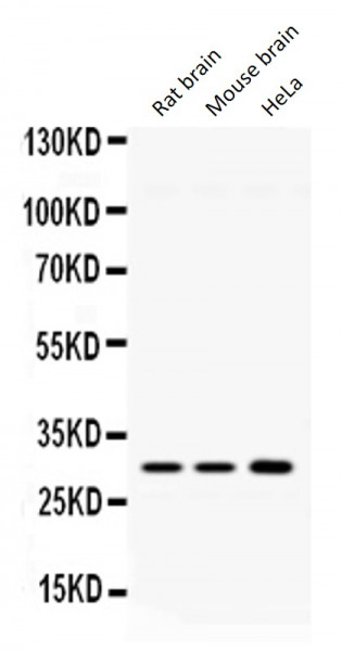 Anti-Aquaporin 11
