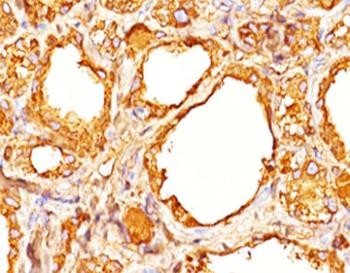 Anti-TG Cocktail / Thyroglobulin, clone 2H11 + 6E1