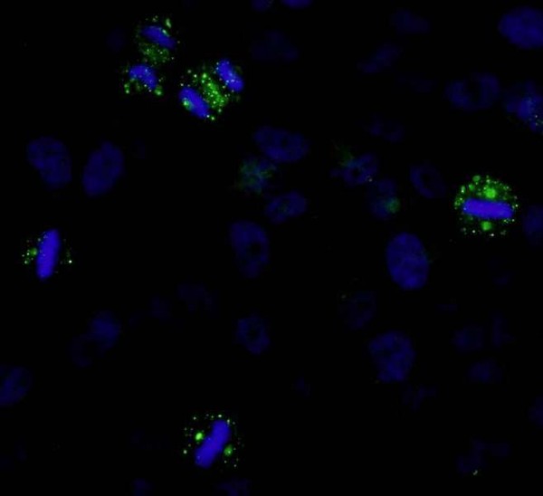 Anti-CDK5RAP2 (IHC)