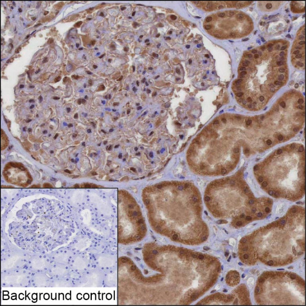 Anti-PPM1A