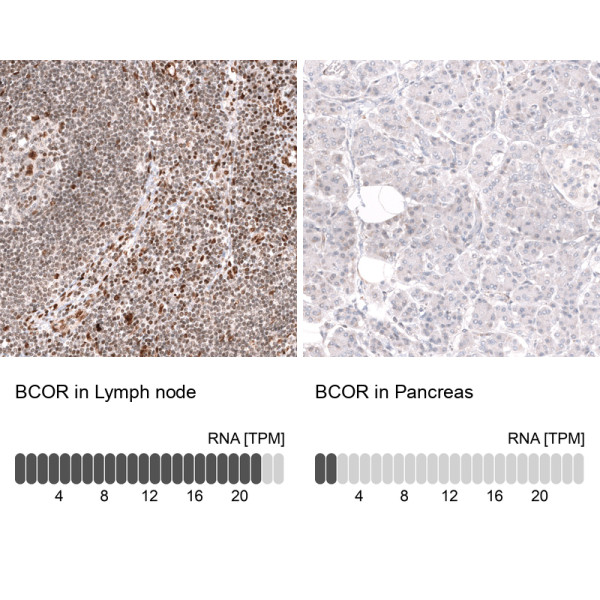 Anti-ABCB5, clone CL13841