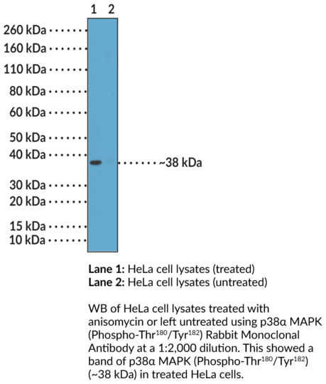 Anti-p38alpha MAPK (Phospho-Thr180/Tyr182) Rabbit Monoclonal Antibody (Clone RM243)