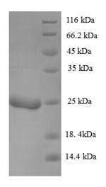 KP6 killer toxin, partial, Ustilago maydis P6 virus, recombinant