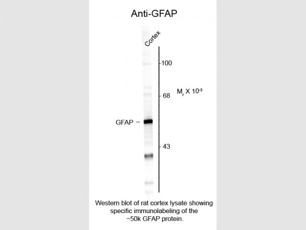 Anti-Glial Fibrillary Acidic Protein (GFAP)