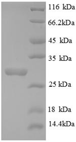 Collagen alpha-3 (IV) chain (COL4A3), partial, human, recombinant