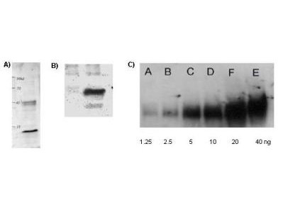 Anti-acetyl-Lysine