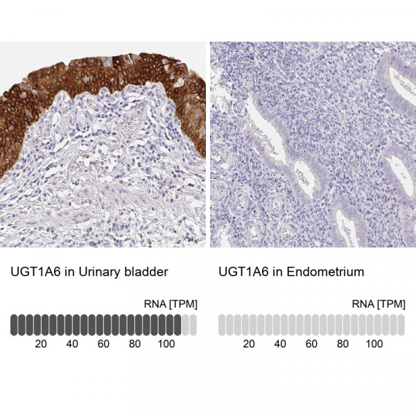 Anti-UGT1A6