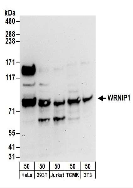 Anti-WRNIP1