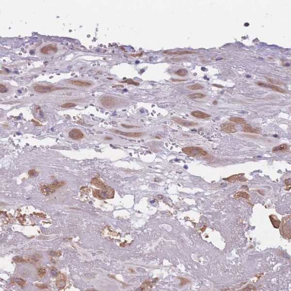 Anti-COL27A1