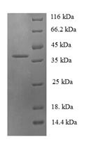 C-C motif chemokine 19 (CCL19), human, recombinant