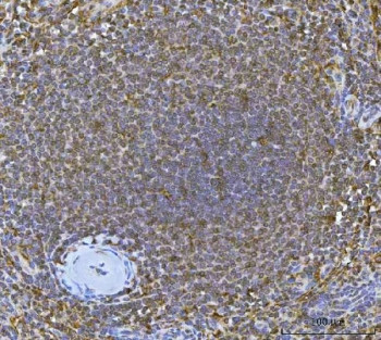 Anti-Interferon regulatory factor 7 / IRF7