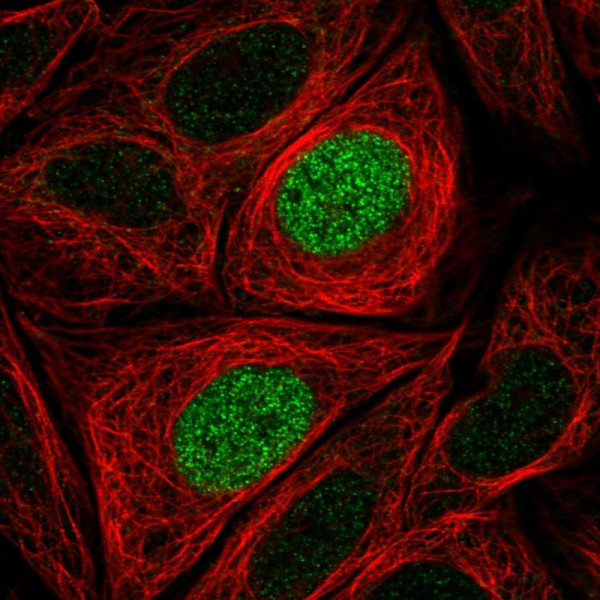 Anti-PHLDB1