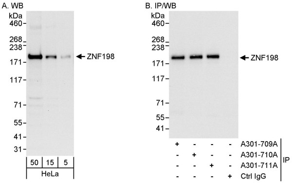 Anti-ZNF198