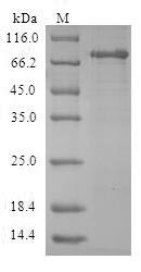 Aminoacylase-1 (ACY1), human, recombinant