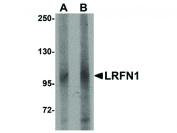 Anti-LRFN1