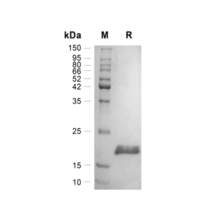 Basic Fibroblast Growth Factor (FGF-2) Recombinant (Mouse)