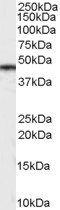 Anti-Casein Kinase 1, delta, Internal