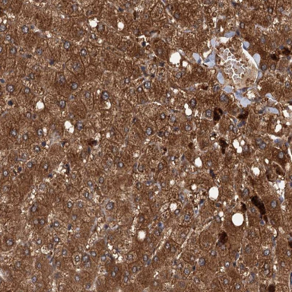Anti-RSAD2