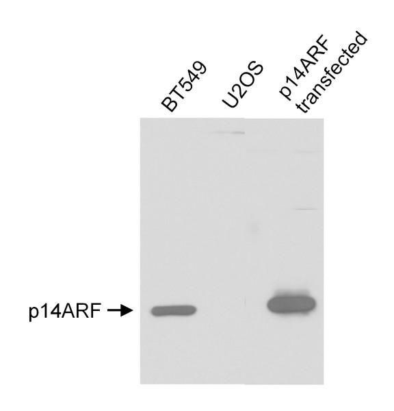 Anti-p14ARF