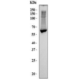 Anti-CES1 / Carboxylesterase 1