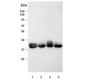 Anti-Tropomyosin, clone TM31