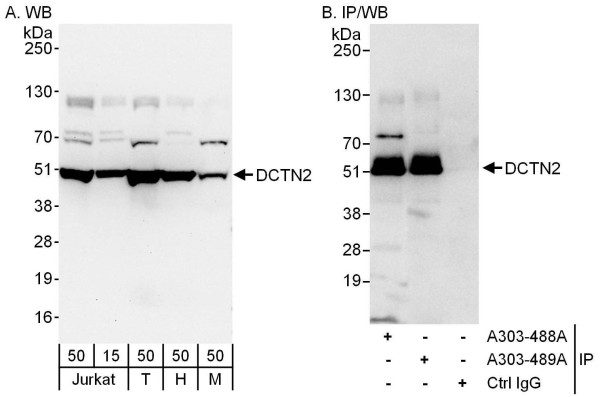 Anti-DCTN2