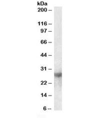 Anti-Galectin-3