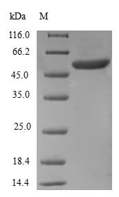 Ras-related protein Rab-5B (RAB5B), human, recombinant